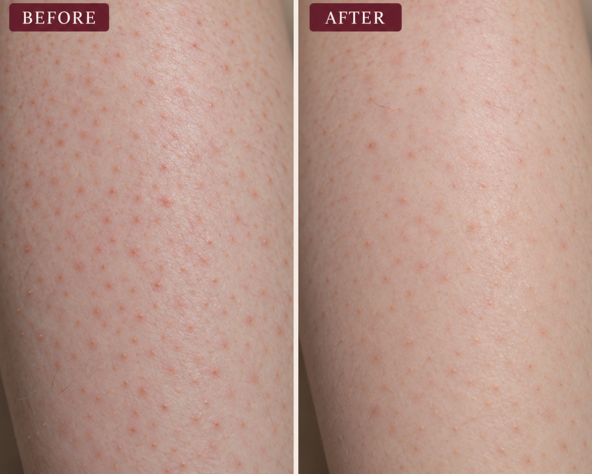 Trelysse Retinal Smoothing Body Serum