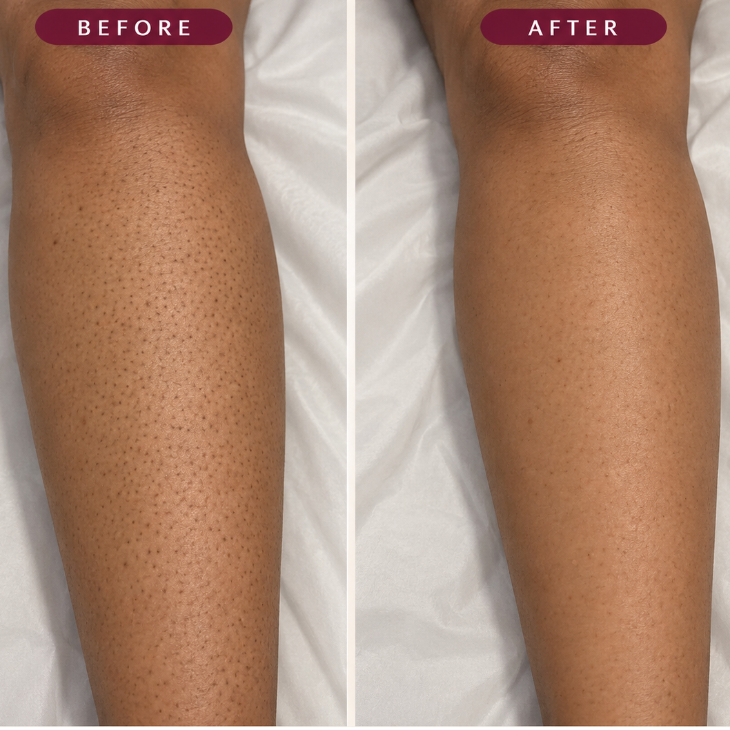 Trelysse Retinal Smoothing Body Serum